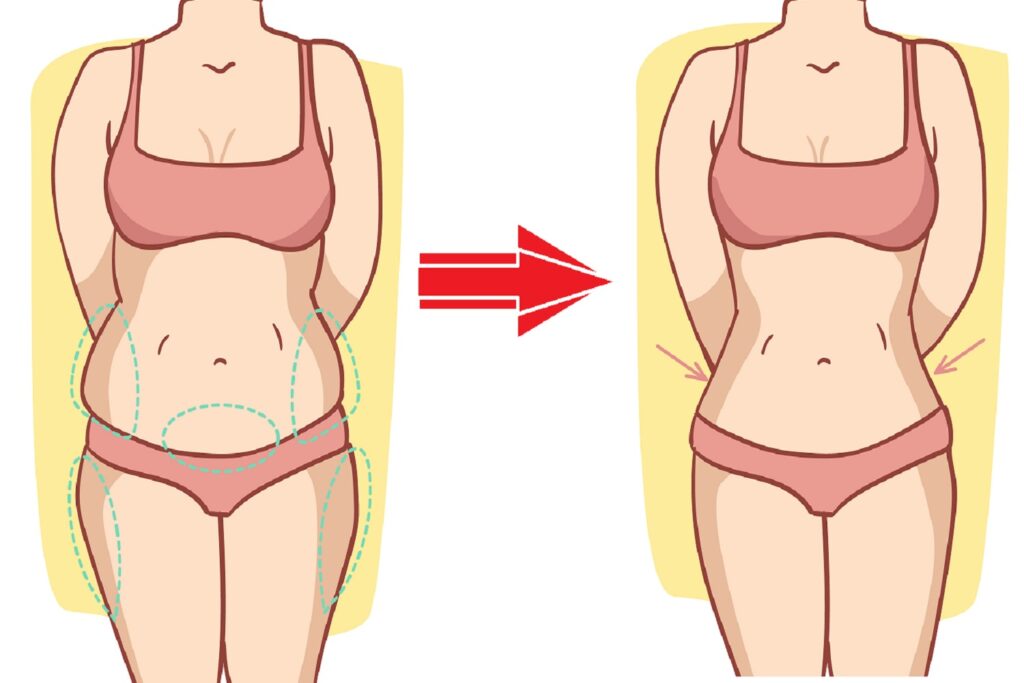 Is It Possible to Eliminate Specific Body Fat With a Spot Reduction Treatment?