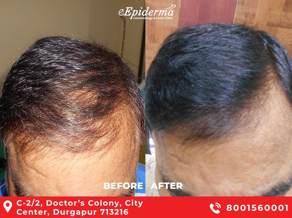 1 Best Protein/Biotin Treatment for Hair in Durgapur